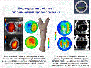Исследования в области гидродинамики  кровообращения (238 Кб)